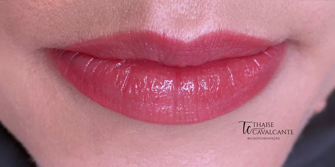 Registro dos mesmos lábios após o procedimento Suavizze Lips